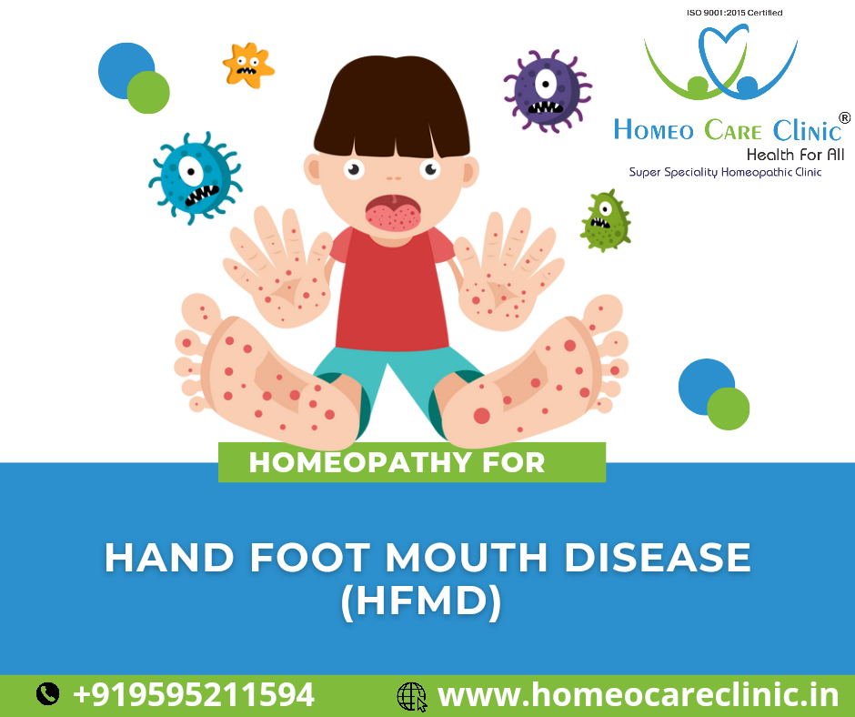 Homeopathic Treatment for Hand, Foot, and Mouth Disease - Homeo Care Clinic