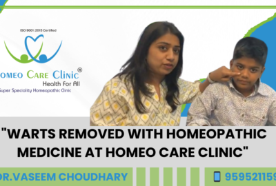 Homeopathy treatment for wart removal