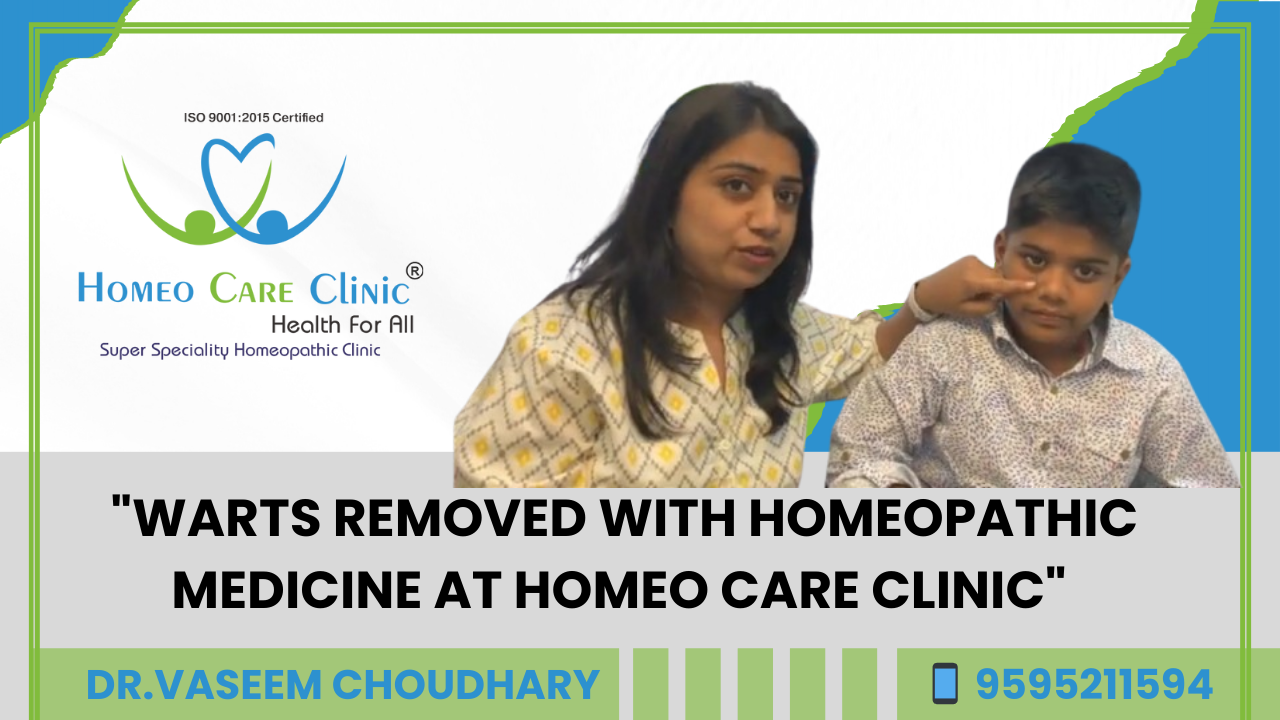 Homeopathy treatment for wart removal