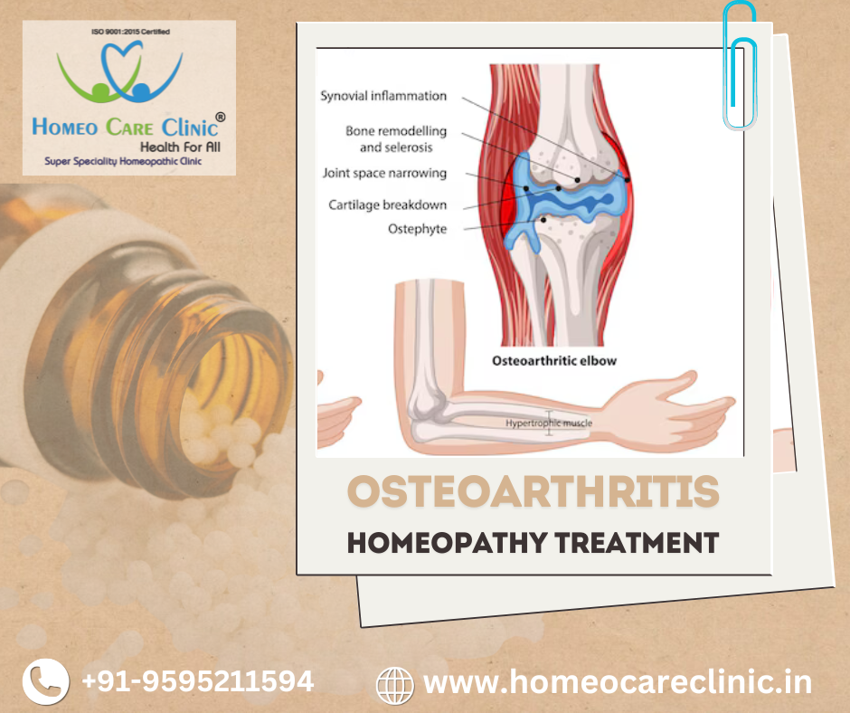 homeopathic treatment for osteoarthritis