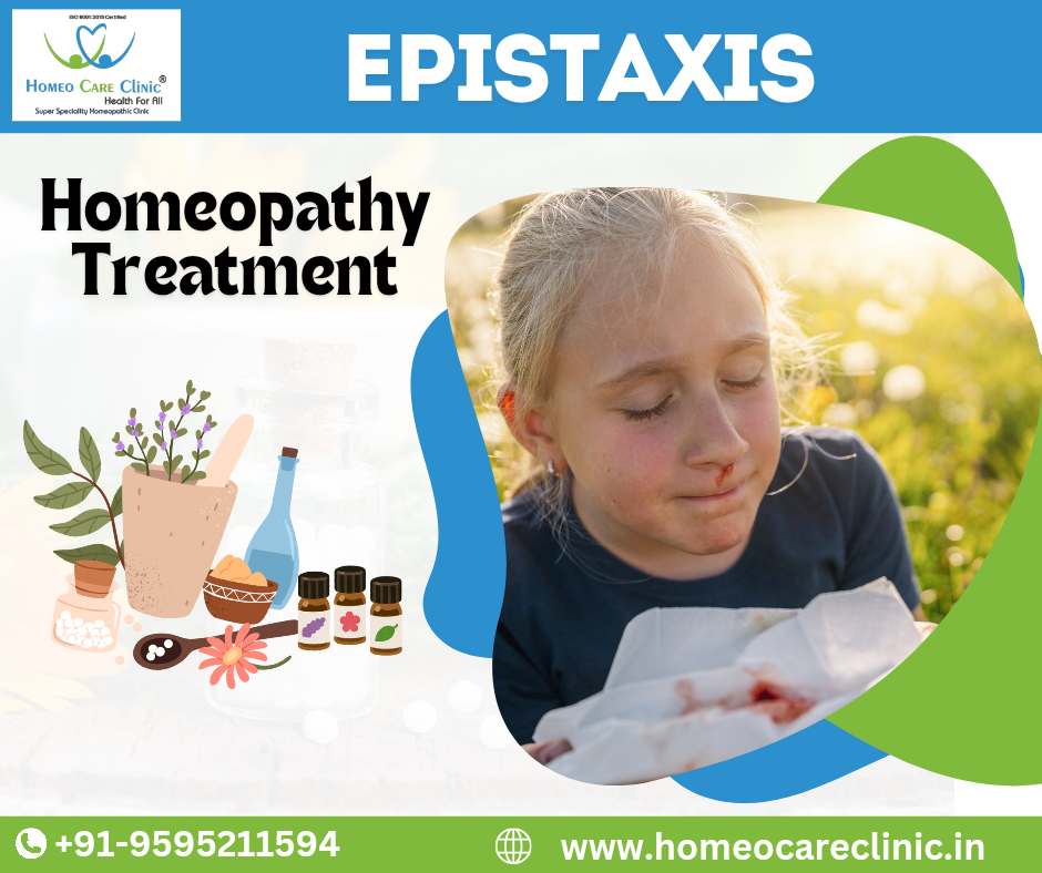 Homeopathic Treatment for Epistaxis