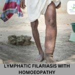 Causes and Symptoms of Lymphatic Filariasis