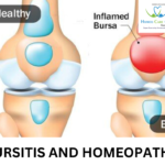 bursitis symptoms and treatment