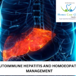 symptoms of autoimmune hepatitis