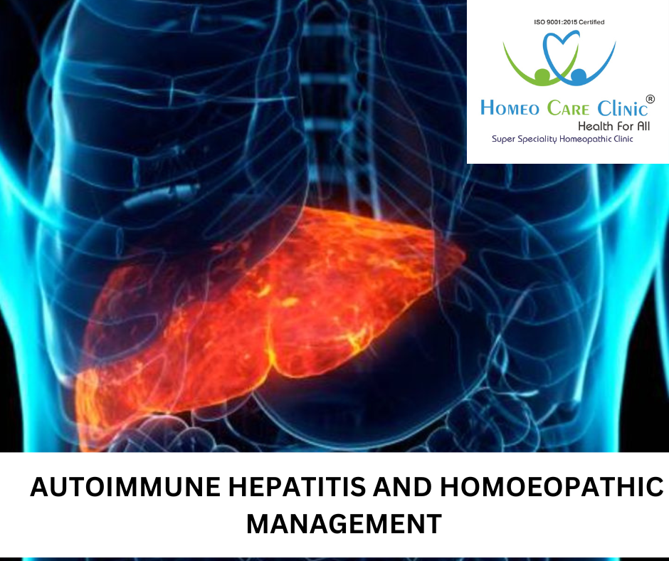 symptoms of autoimmune hepatitis