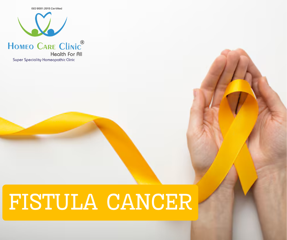 Homeopathic Treatment for Fistula Cancer