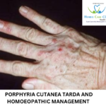 Porphyria Cutanea Tarda (PCT)