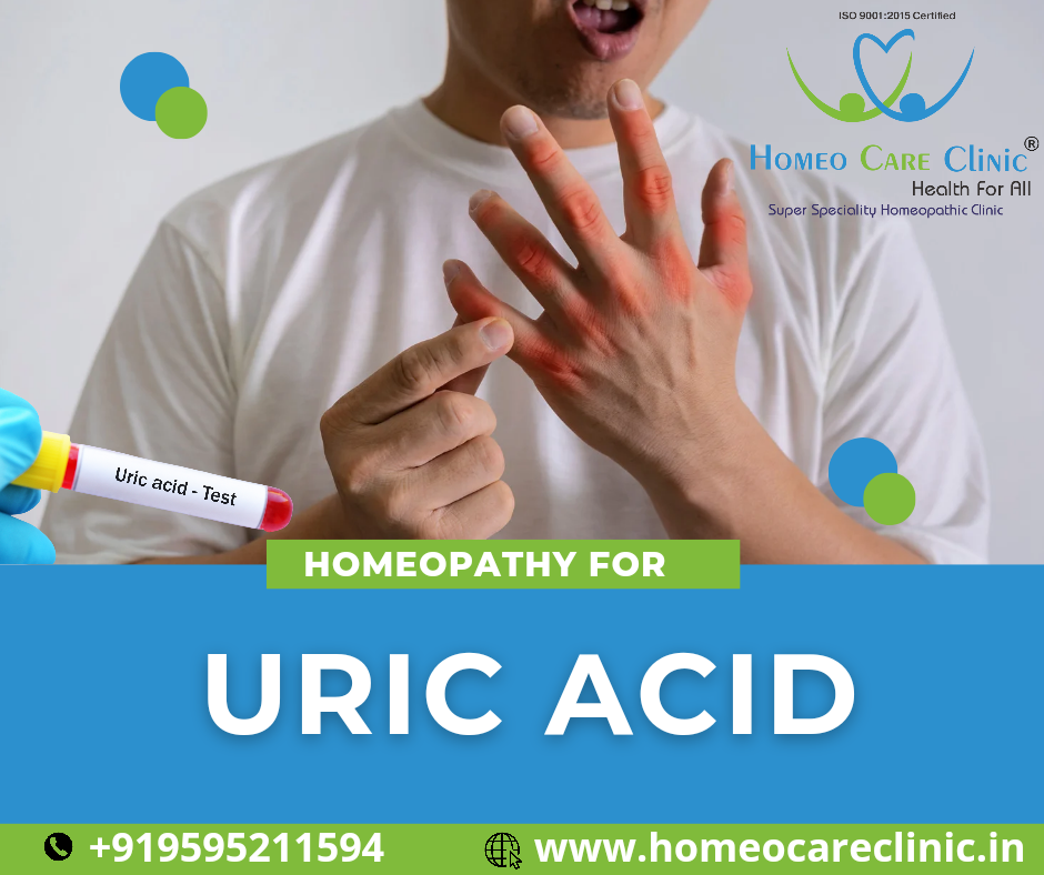 Homeopathic treatment for high uric acid