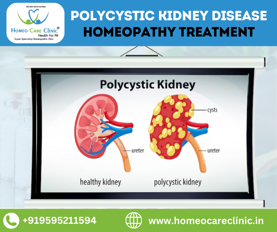 homeopathic treatment for Polycystic Kidney Disease