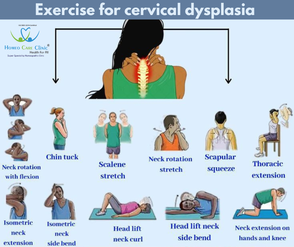 Exercise for Cervical Dysplosia