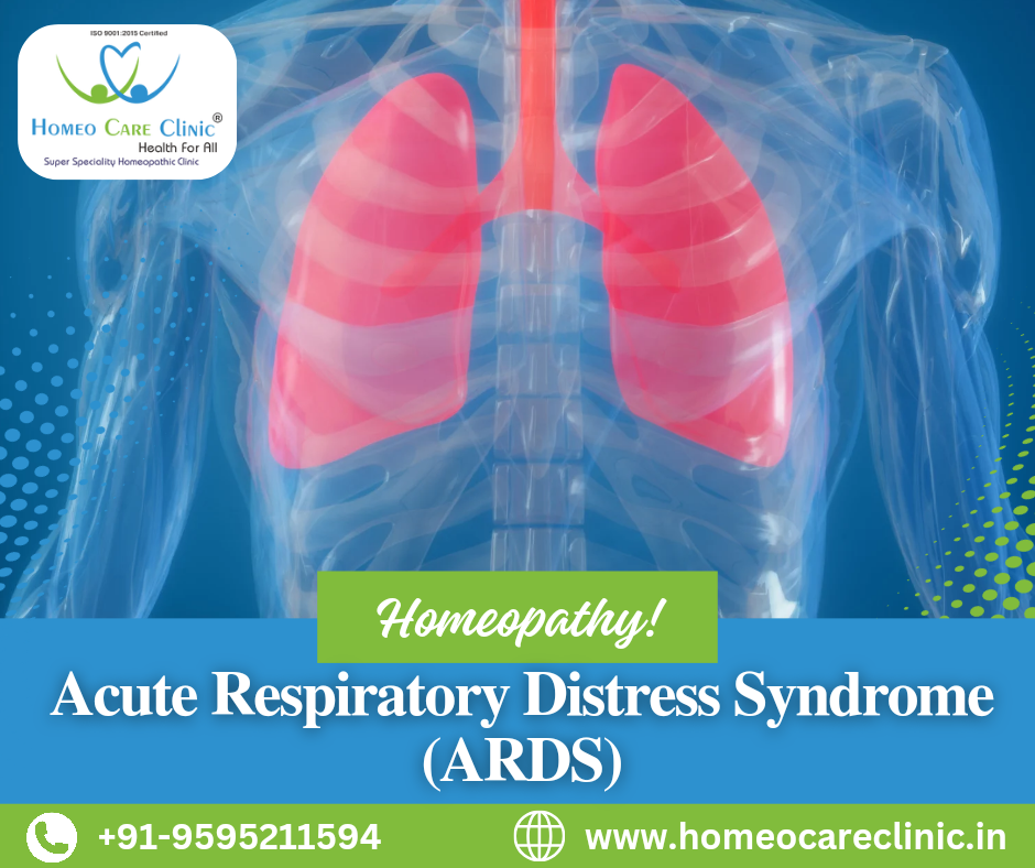 Homeopathic remedies for Acute Respiratory Distress Syndrome (ARDS) treatment