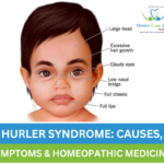 Hurler's Syndrome symptoms