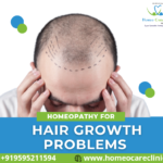 Homeopathic remedies for natural hair growth and hair loss prevention