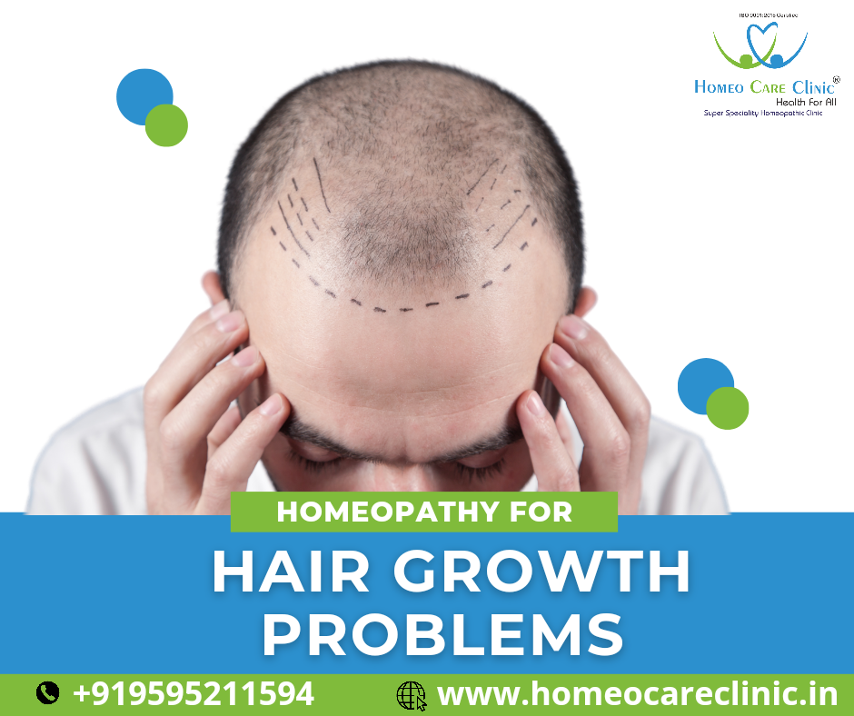 Homeopathic remedies for natural hair growth and hair loss prevention