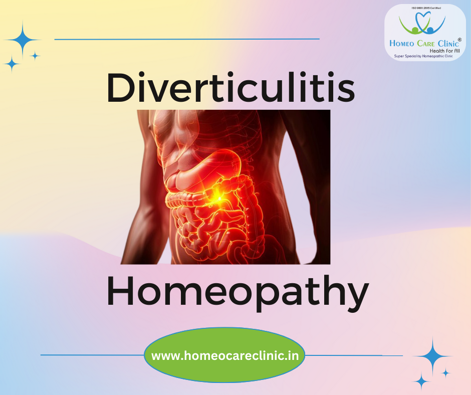 Homeopathy for Diverticulitis