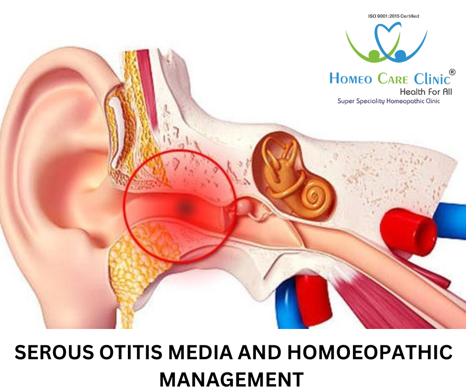 symptoms of Serous Otitis Media