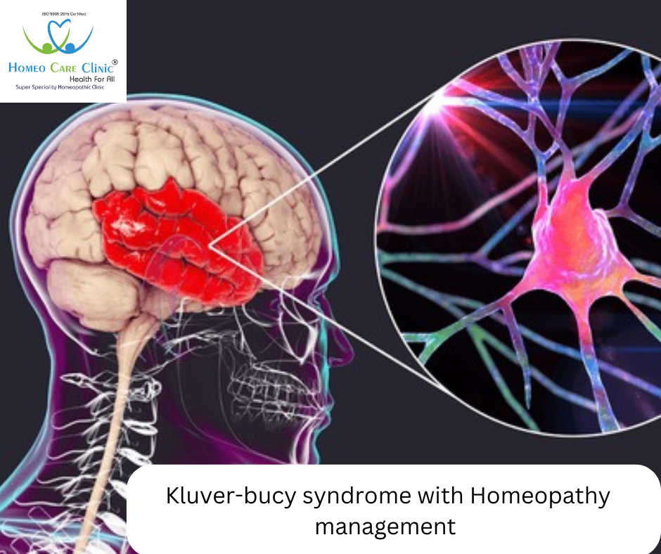 A conceptual illustration depicting brain regions affected in Klüver-Bucy Syndrome.