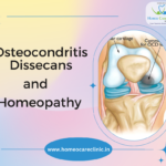 Homeopathic treatment for Osteochondritis Dissecans