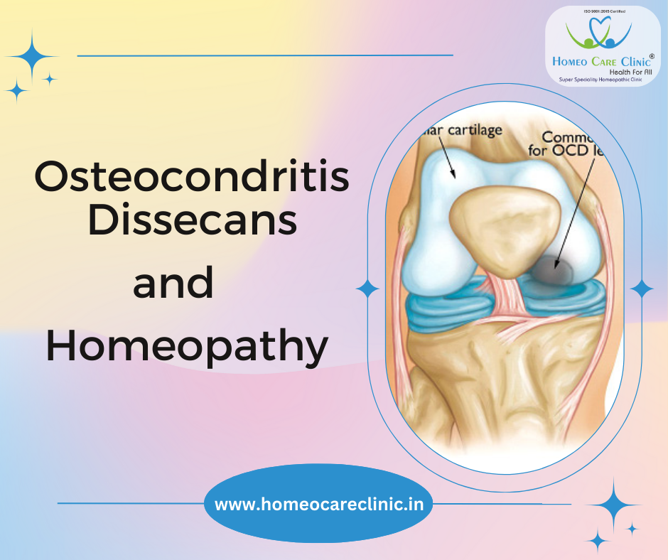 Homeopathic treatment for Osteochondritis Dissecans