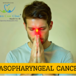 Holistic Homeopathic Treatment for Nasopharyngeal Cancer