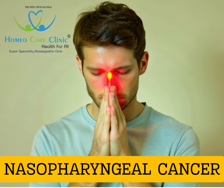 Holistic Homeopathic Treatment for Nasopharyngeal Cancer