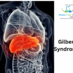 Gilbert syndrome risk factors