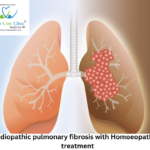 Homeopathy for Idiopathic Pulmonary Fibrosis