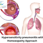 types of hypersensitivity pneumonitis