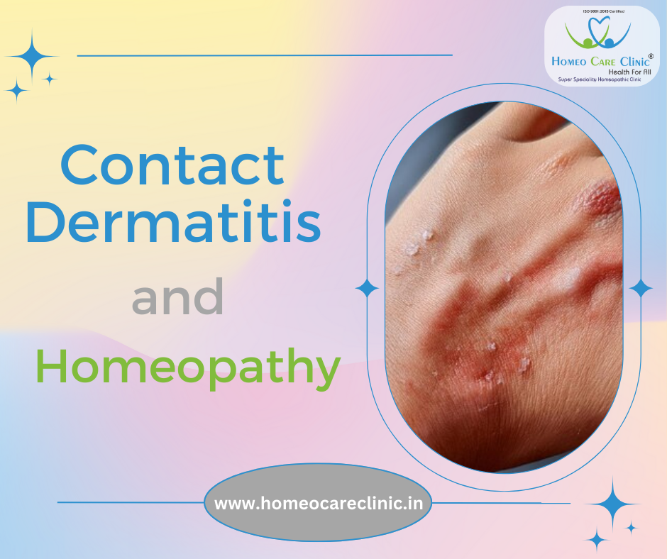 Contact Dermatitis Homeopathy Treatment