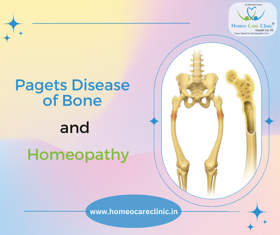 paget's disease of bone diagnosis