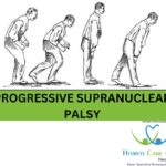 Supranuclear Palsy treatment