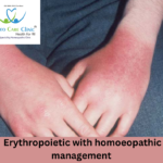 Erythropoietic Protoporphyria treatment