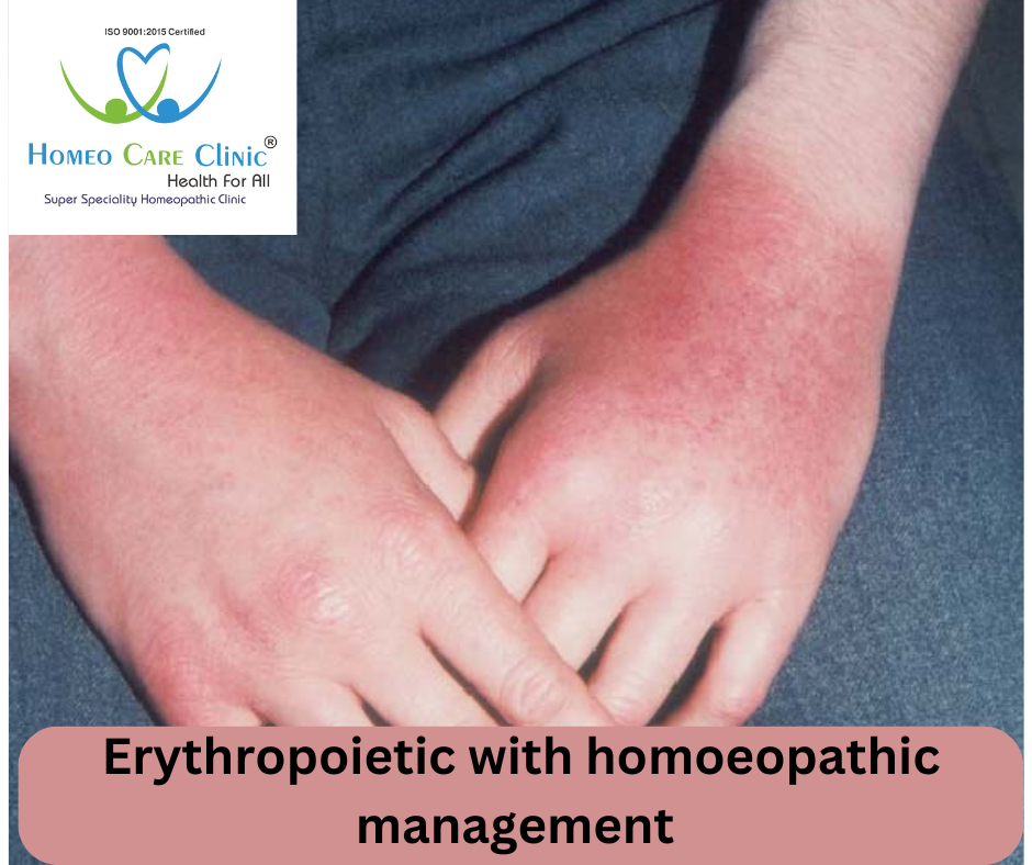 Erythropoietic Protoporphyria treatment