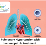 Pulmonary hypertension treatment and symptoms explained with homeopathic remedies