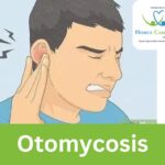 Otomycosis treatment with natural remedies