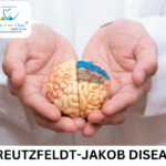 EEG findings in Creutzfeldt-Jakob Disease