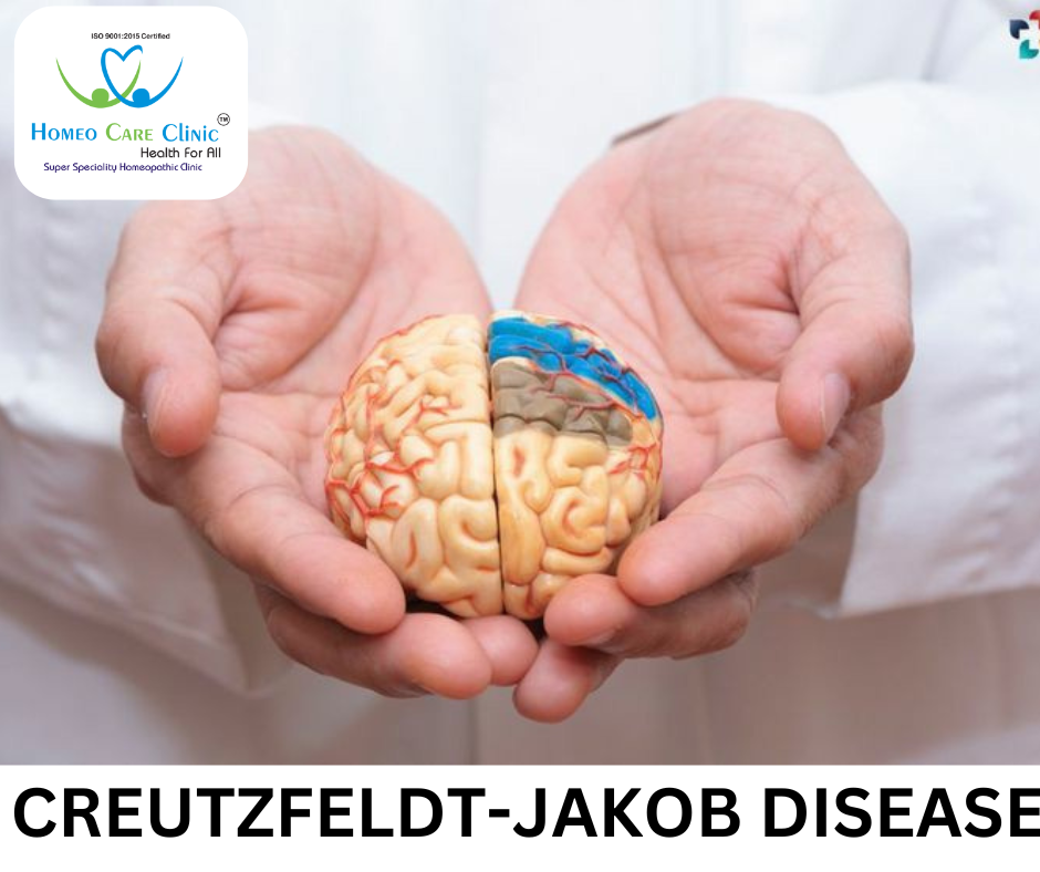 EEG findings in Creutzfeldt-Jakob Disease