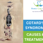 Cotard's Syndrome treatments