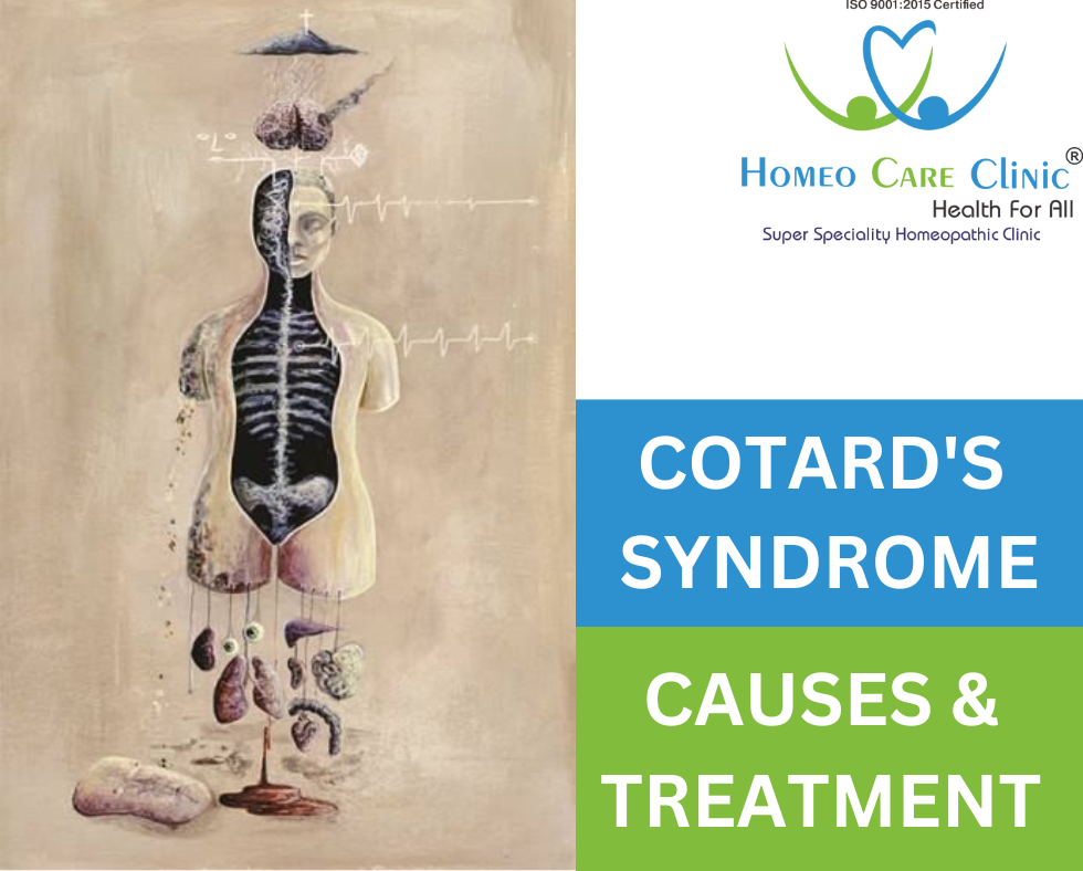 Cotard's Syndrome treatments