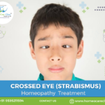 Solutions for crossed eyes through homeopathy.