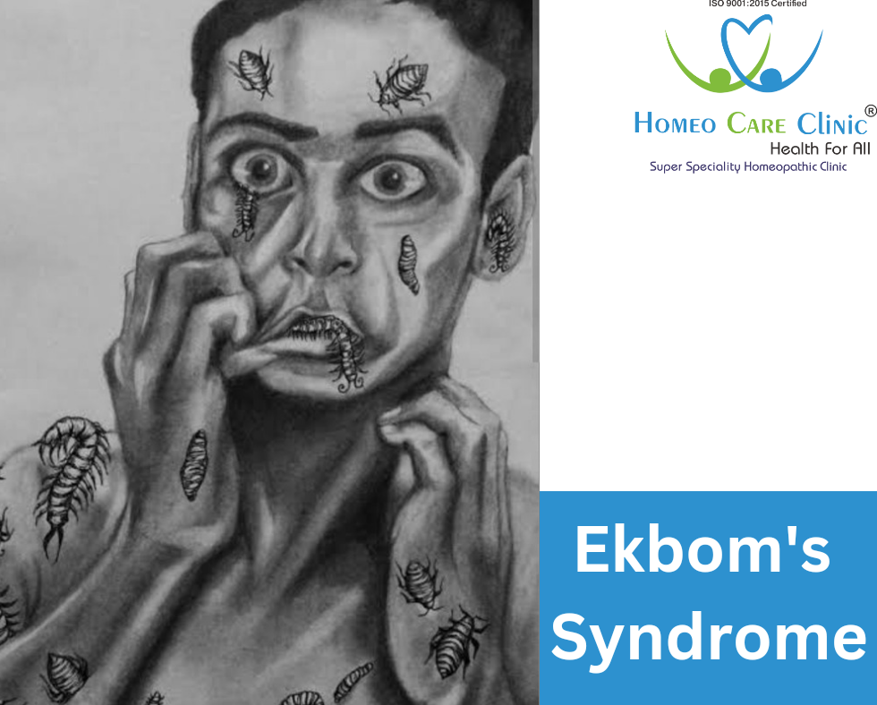 Treatment for Ekbom's Syndrome