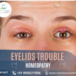 Relief from eyelid troubles