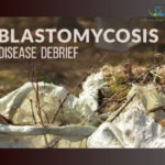 Treating Blastomycosis symptoms with homeopathy