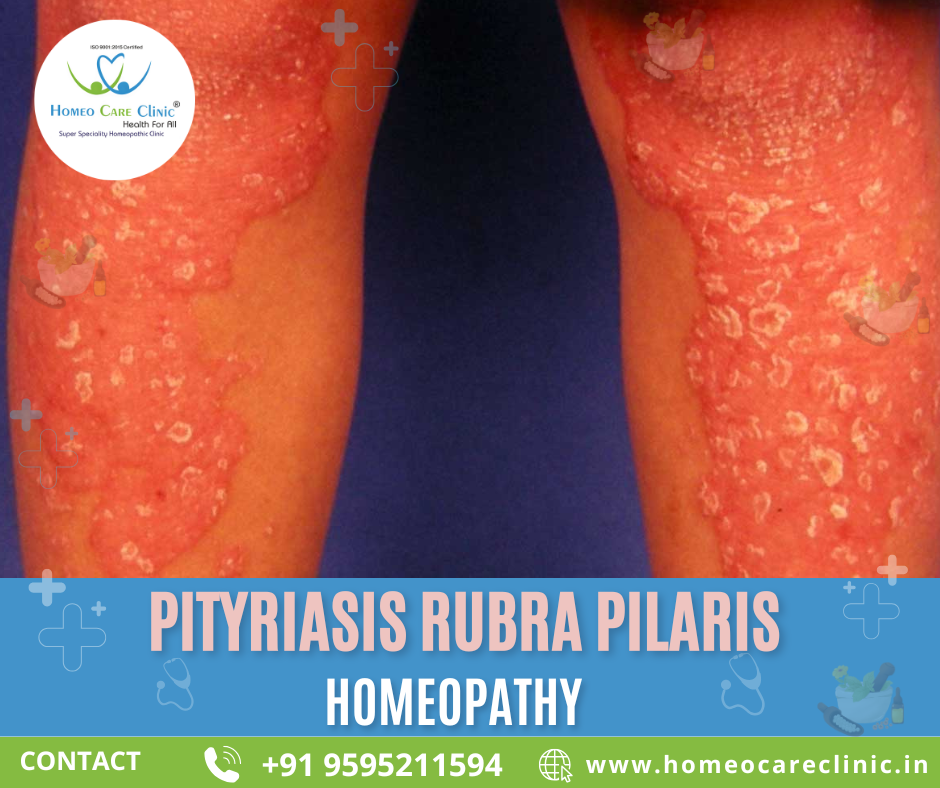 Pityriasis Rubra Pilaris symptoms