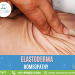 skin elasticity issues caused by Elastoderma