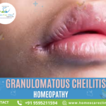 Granulomatous cheilitis causes