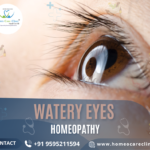 Watery Eyes Treatment