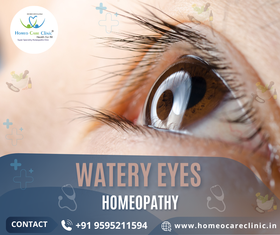 Watery Eyes: Causes, Symptoms, And Holistic Homeopathic Care