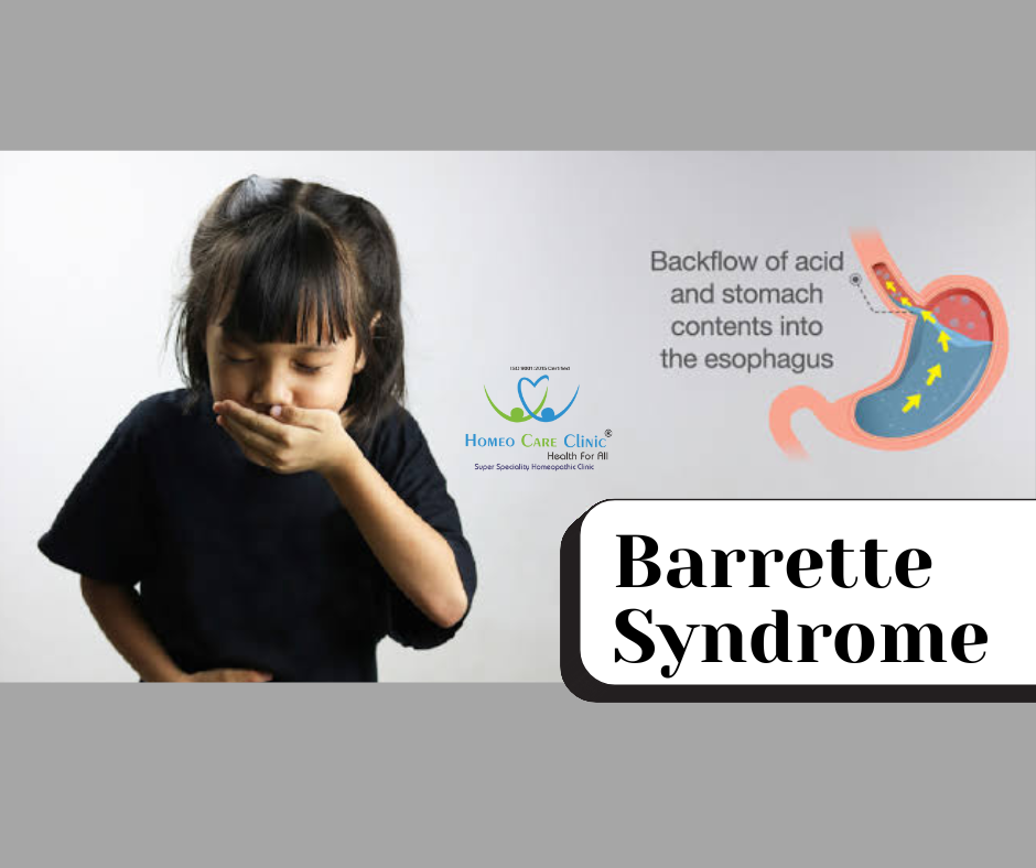 Barrett’s Disease causes