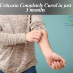 Urticaria treated in 3 months using homeopathy.